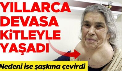 Doktordan korktuğu için 50 yıldır devasa kitleyle yaşadı! Ameliyat sonrası ilk sözleri ‘Korkulacak bir şey yokmuş’ oldu